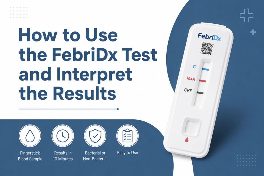 How to use Febridx Test